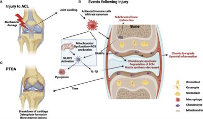 Mitochondria in Injury, Inflammation and Disease of Articular Skeletal Joints